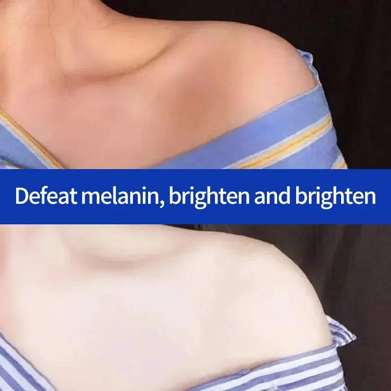 Brightening Body Lotion for Men & Women – Moisturizing, Whitening & Exfoliating | 400ml
