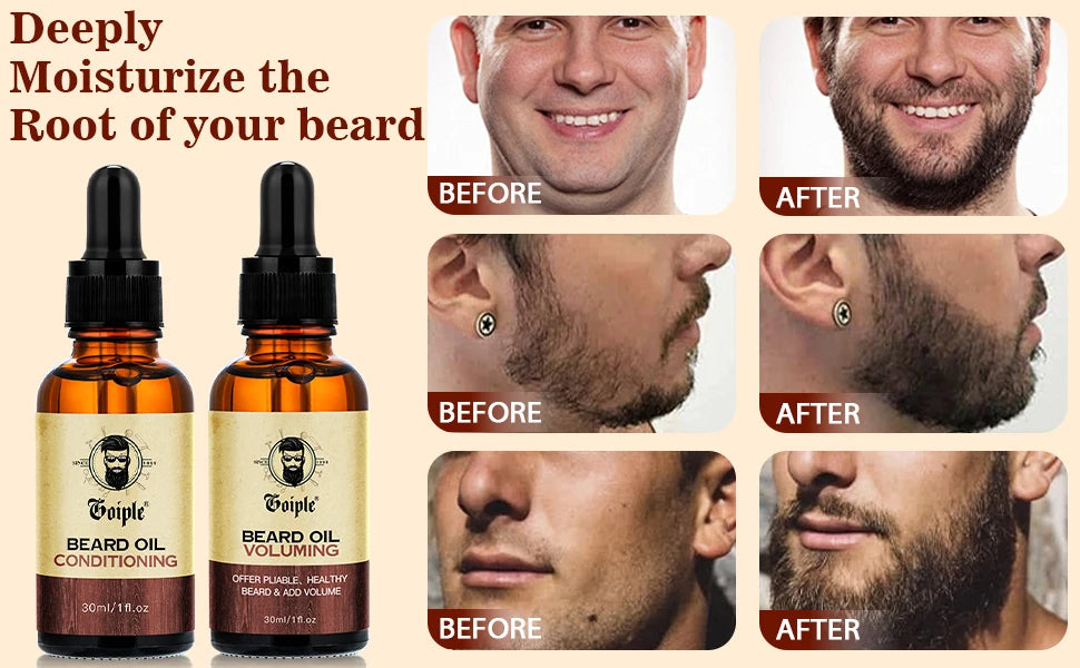 Trío Vikingo para el Cuidado de la Barba – Set de Aceites Naturales Hidratantes y Voluminizadores para Barba (3 piezas)