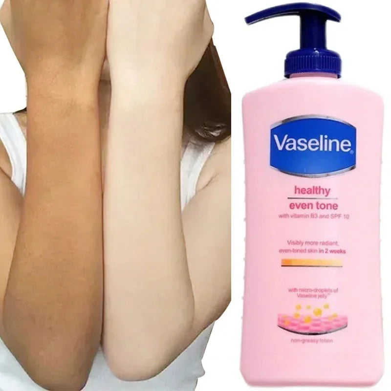 Brightening Body Lotion for Men & Women – Moisturizing, Whitening & Exfoliating | 400ml