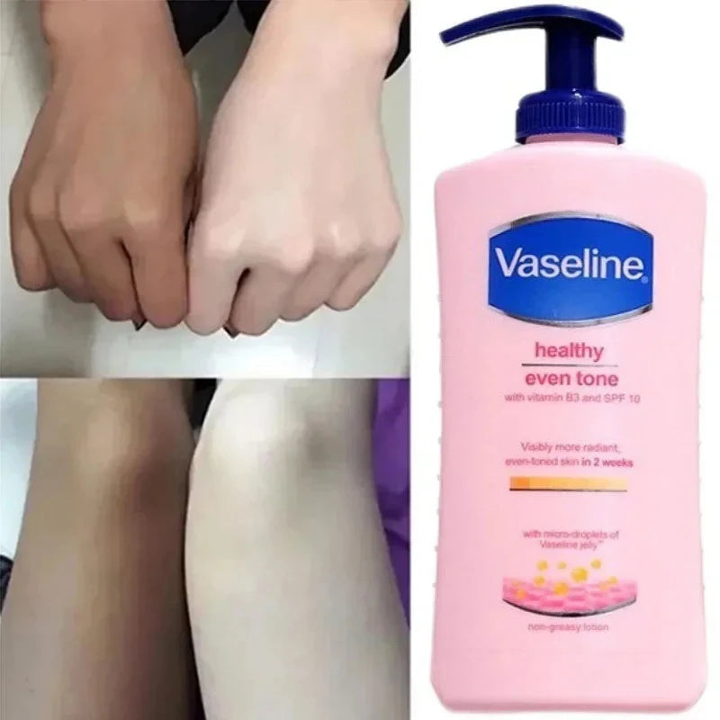 Brightening Body Lotion for Men & Women – Moisturizing, Whitening & Exfoliating | 400ml